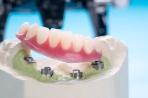 close up of a traditional dentures