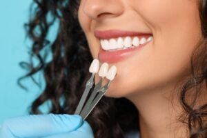 closeup of dentist holding veneer colors to a woman's teeth, light blue background