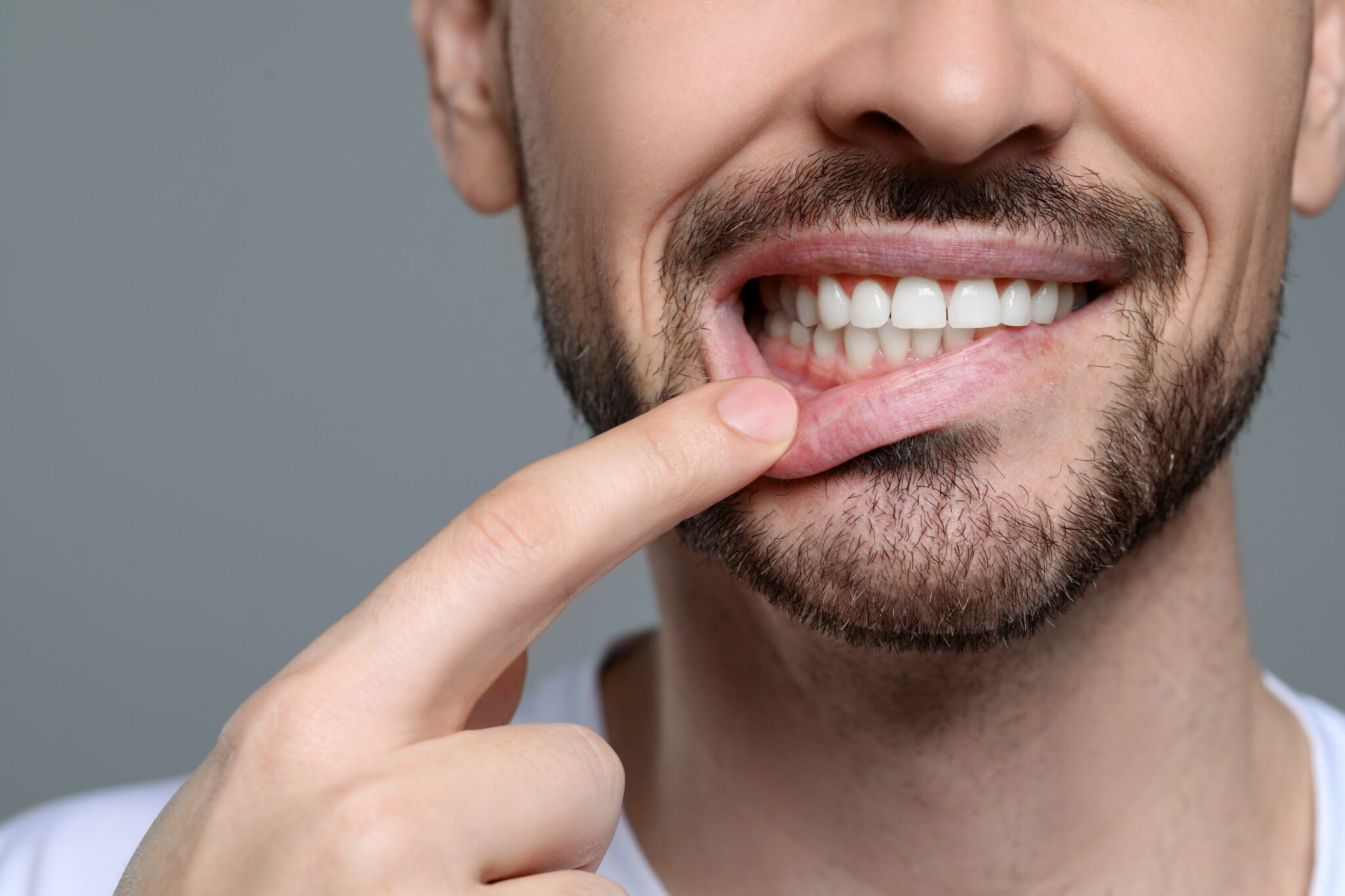 closeup of a man showing his healthy gums, grey background